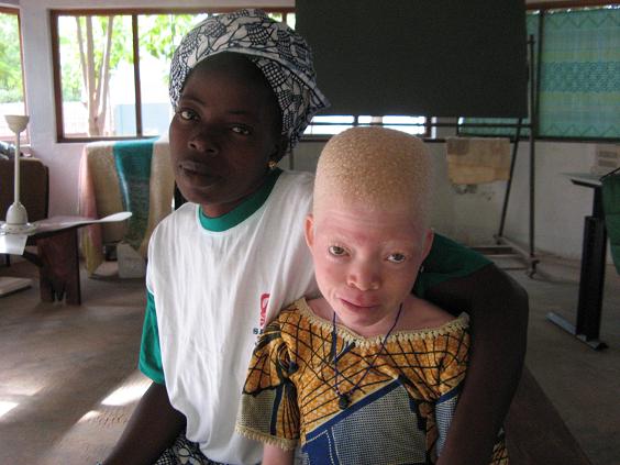 Tenna Colette Albinomeisje